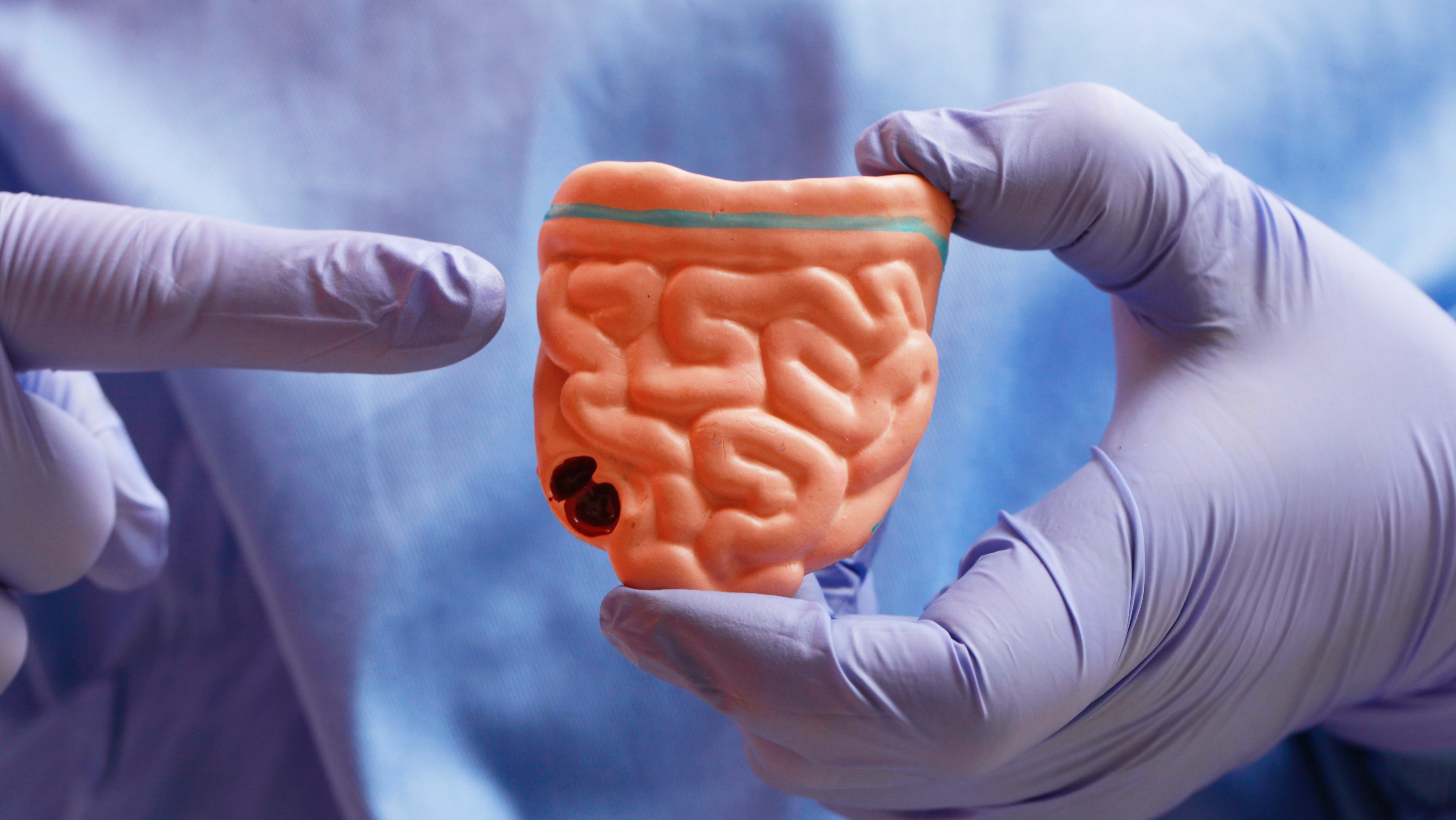 请善待你的肠子 肠道细菌不仅影响脑子还影响药效 第1张-心情说说 请善待你的肠子 肠道细菌不仅影响脑子还影响药效 第1张