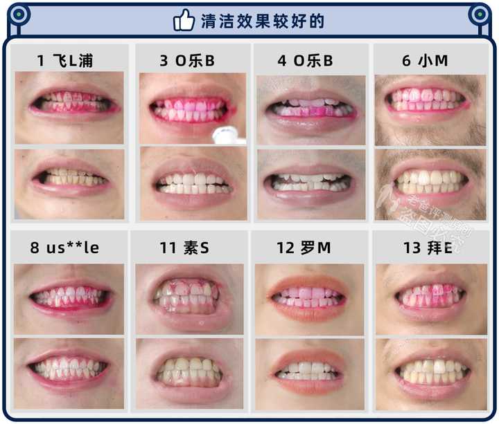 实测13款热门电动牙刷，到底哪款刷得更干净？-11