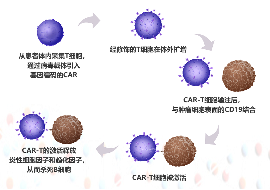 CAR-T治疗